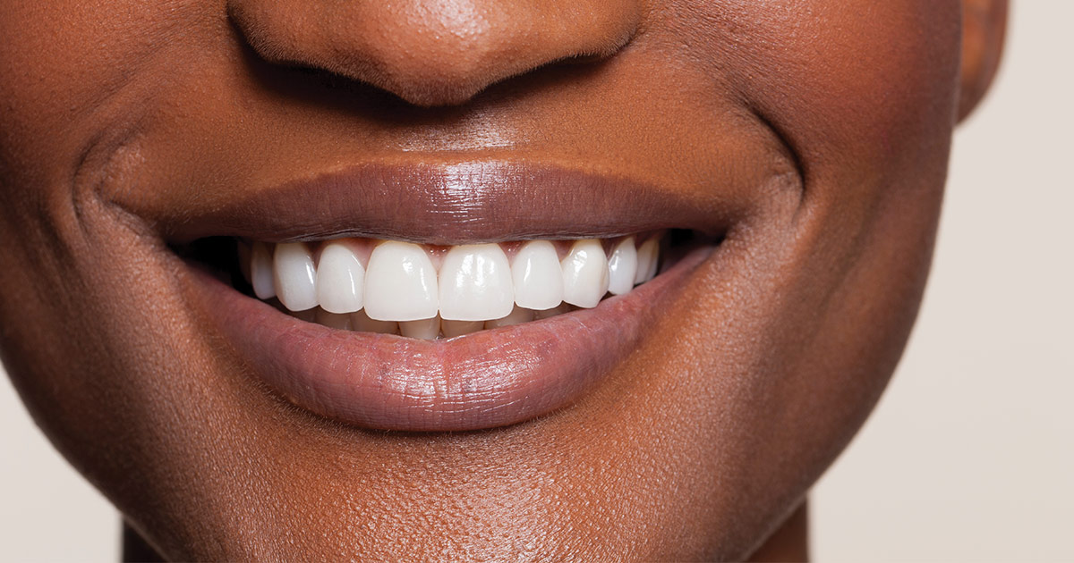 Finding Your Smile Again Through Cosmetic Dentistry
